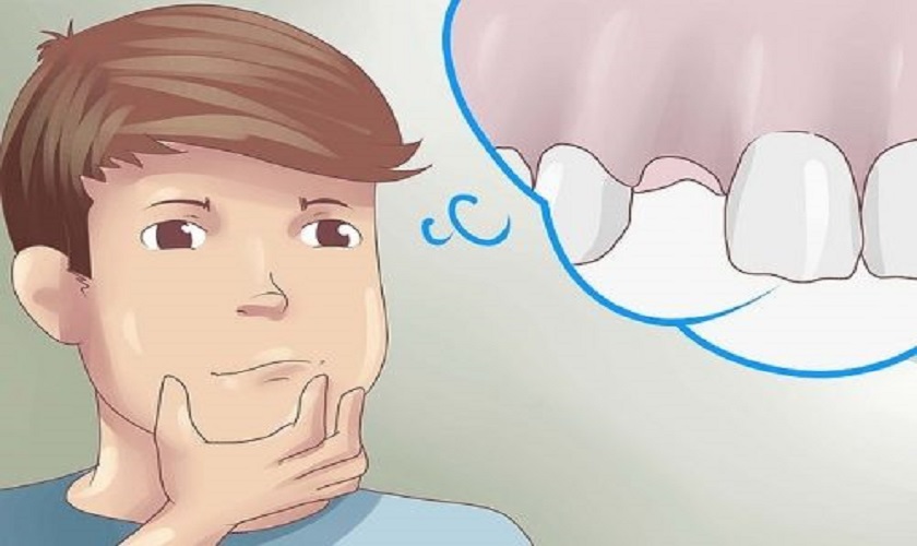 mơ bị rụng răng